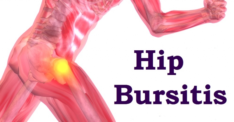 Hip Bursitis Symptoms Relief And Physical Therapy Rehab Experts